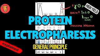 PROTEIN ELECTROPHARESIS and IMMUNOFIXATION Explained [upl. by Johppah505]