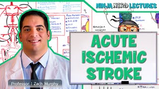 Acute Ischemic Stroke Etiology Pathophysiology Clinical Features Diagnostics Treatment [upl. by Tnek]