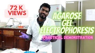 Agarose gel electrophoresis [upl. by Kent]