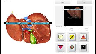 Biophilia Tracker X4 MAX Demo [upl. by Zurc]