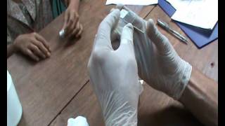 How to Perform a Proper Thick and Thin Smear for Malaria Diagnosis [upl. by Iago]