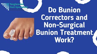 Do Bunion Correctors and NonSurgical Bunion Treatment Work [upl. by Grounds]