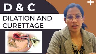 Dilation and curettage D ampC Dos amp Donts after DampC DampE FAQs [upl. by Eciryt]