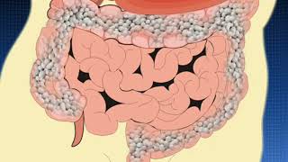 Салофальк  лекарственные формы болезнь Крона ВЗК © Salofalk  dosage forms Crohns disease IBD [upl. by Aggie33]