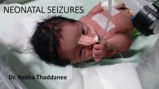 Neonatal Seizures  Pediatrics [upl. by Rafi300]