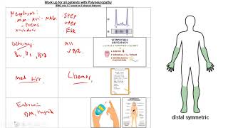 Morning Report Peripheral Neuropathy Mononeuritis Multiplex and approach to Paraproteinemia [upl. by Ycnuahc]