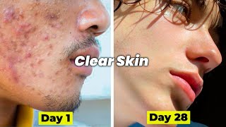 How to get clear skin in 28 days  Glowing skin [upl. by Rehoptsirhc]