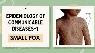 SMALL POX  VARIOLA EPIDEMIOLOGY OF COMMUNICABLEDISEASES1 [upl. by Kennet]