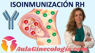 ISOINMUNIZACIÓN RH GAMMAGLOBULINA ANTIG VACUNA TRATAMIENTO  Ginecología y Obstetricia [upl. by Ahseyk257]