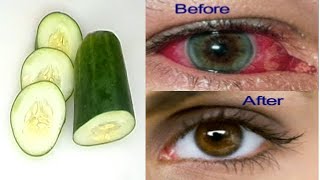 WITH CUCUMBER FORGET YOUR GLASSES AT HOME IMPROVE YOUR EYESIGHT OVERNIGHT [upl. by Lapham]