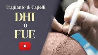 Trapianto di capelli FUE o DHI Qual è la scelta migliore nel 2023 [upl. by Gnoud]