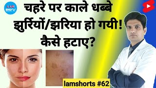 चहरे पर काले धब्बे झुर्रियों तथा झाइया हो गयी कैसे हटाए Shorts lamshorts [upl. by Ruhnke]