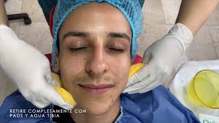 NUEVO FACIAL con Dermaheal con tecnica nanopunta paso a paso para piel de porcelana [upl. by Kassia]