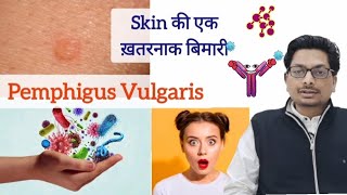 Pemphigus  skin की एक ख़तरनाक बिमारी  चमड़ी और मुँह में छाले और घाव pemphigus oralulcer ulcers [upl. by Aimas]