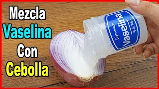 Mezcla Vaselina con Cebolla y estarás impresionada por lo que pasará lo querrás hacer a diario [upl. by Hew754]