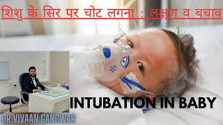 Gasping Condition In Baby  Paediatric Intubation  Intubation Procedure In Newborn  Intubation [upl. by Eciuqram]