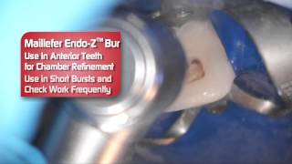 Dentsply EndoZ Bur  Review by Dr Scott Norton [upl. by Adrienne]