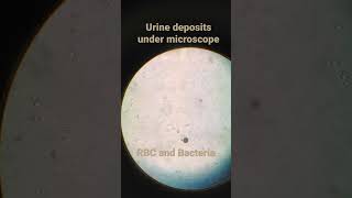 RBC and bacteria under microscope  Urine examination  medicallabtechnologysajal6903 [upl. by Elorak488]