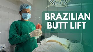 Brazilian Butt Lift  BBL  Buttock Enlargement  Butt Lift  Fat Transfer  Body Shaping [upl. by Saturday]