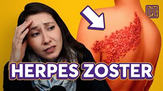 Como se pega Herpes Zoster [upl. by Omland476]