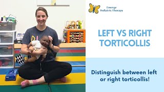 Left or Right Torticollis [upl. by Rolan]