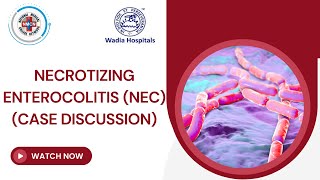 Necrotizing Enterocolitis NEC  Case Discussion [upl. by Dranek876]