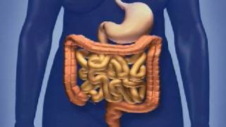 Screening for Colorectal Cancer [upl. by Mccullough752]