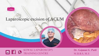 Laparoscopic excision of ACUM Kewal Hospital  Laparoscopy Training [upl. by Uohk]