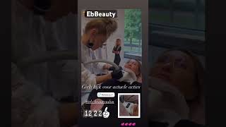 cryolipolyse beauty keşfet beautysalon shortvideo viral onderkin [upl. by Malory]