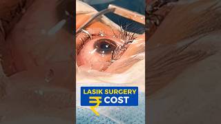 LASIK Surgery Cost [upl. by Yelrah557]