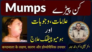 Mumps کن پیڑے कण्ठमाला का रोग Homeopathic Treatment Symptoms by DrWaqar Bhutta  Urdu  Hindi [upl. by Eimirej]