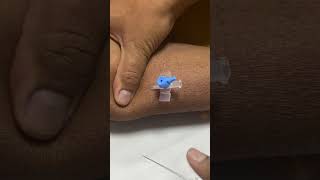 IV cannula insertiondocternursingmotivationviralvideoshortvideo [upl. by Nira]