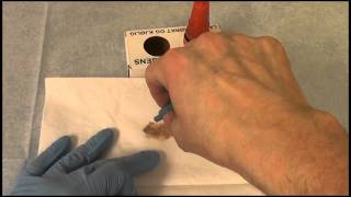 hemofec testing for faecal occult blood loss [upl. by Pinkerton448]