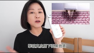 Youtuber Emi 3個月實測🔎去斑醫療美容儀│全韓國香港首部獲韓國醫療協會及食藥署認證的去斑醫療美容儀「Melashot」 [upl. by Alithea]