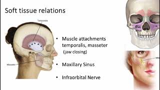 Fractures  DrElavenil Panneerselvam Professor  Department of Oral amp Maxillofacial Surgery [upl. by Akeimahs]