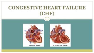 Congestive heart failure CHF Introduction Pathophysiology and Treatment 💗 [upl. by Averir697]