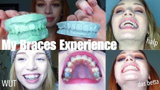 3 YEARS OF BRACES IN UNDER 30 MINS  VLOGstyle experience  transformation quotglowupquot [upl. by Adnoral]