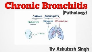 Chronic Bronchitis ll Respiratory Pathology [upl. by Darreg]