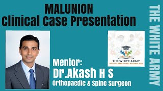 MALUNION Clinical Case Presentation [upl. by Caughey]