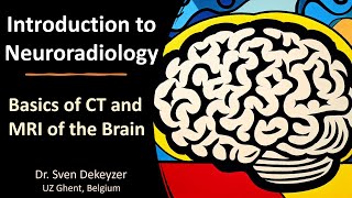 Basics of CT and MRI of the brain introduction to Neuroradiology [upl. by Anyar161]