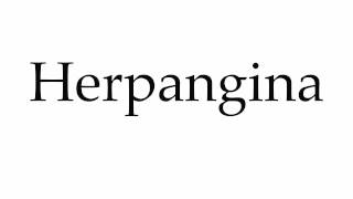 How to Pronounce Herpangina [upl. by Pomona]