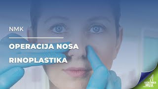 NMK  Operacija nosa  Rinoplastika [upl. by Nicolle]