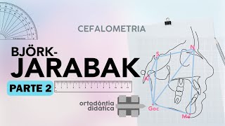 Cefalometria de BJÖRK  JARABAK  Parte 2 [upl. by Franci]