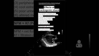 Effects of cardiogenic shock [upl. by Rogergcam]