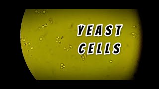 Yeast cells in stool routine Microscopy  labmedicine9265 [upl. by Felicia589]