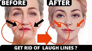 FACE YOGA FOR SMILE LINES  LAUGH LINESNASOLABIAL FOLDS GET RID OF WRINKLES [upl. by Tdnarb502]