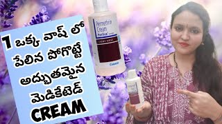 permethrin prelice cream review in Telugu పేలు క్షణంలో పోతాయిprelicecream permethrin lices [upl. by Alleciram985]