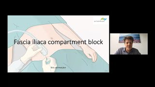 Suprainguinal Fascia Iliaca Block for Perioperative Analgesia after Total Hip Arthroplasty [upl. by Donahoe685]