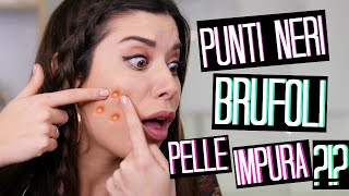 PUNTI NERI BRUFOLI E PELLE IMPURA😱COME RICEVERE PRODOTTI GRATIS  💸  Adriana Spink [upl. by Aynotal945]