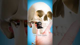 How To Fix A Dislocated Jaw 😨shorts animation usa canada australia [upl. by Lynda]